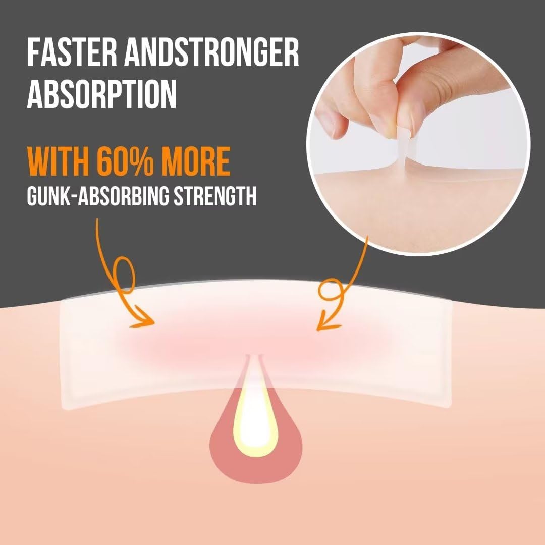 AUSLKA Large Blemish Zit Patches XL - 20 Strips - Hydrocolloid Dots -Blemishes Patch - Zit Breakouts - Blemishes Stickers - Max Size