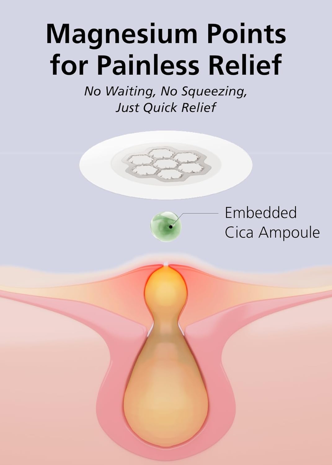 EasyDerm Quick Calming Magnesium Patches – 30 Patches Bulk Pack, Individually Wrapped Acne Care, Includes Tweezers & Ampoule, Korean Skincare, Made by Daewoong Pharmaceutical