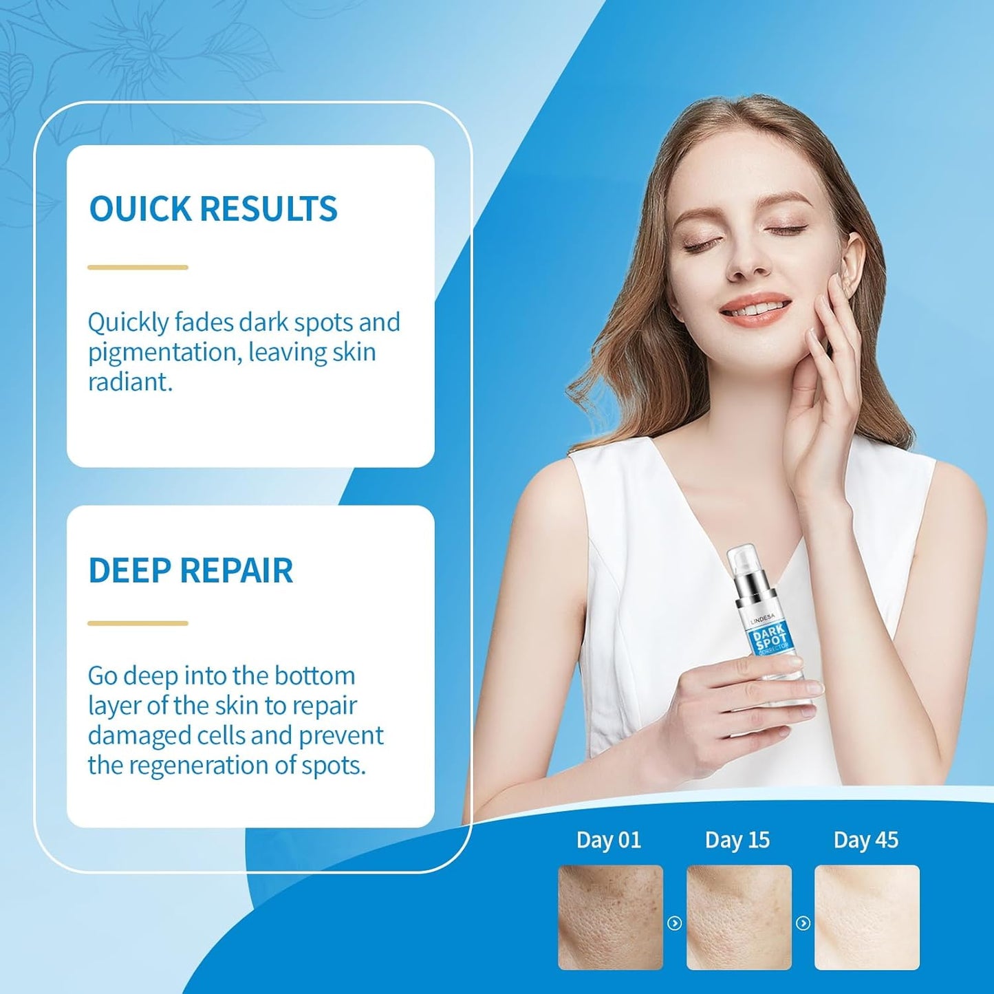 Dark Spot Remover for Face,Dark Spot Corrector, Dark Spot Serum for Sun Spots, Age Spots, Brown Spots,Acne Scars,Melasma Brown Spot -Advanced Formula with Niacinamide Retinol for Women (1.0 Fl Oz)