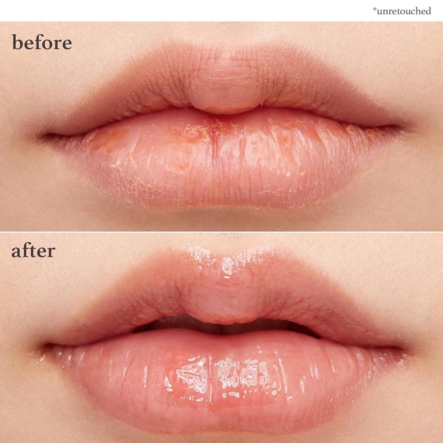 NOONI Vegan Applebutter Lip Mask Overnight – Hydrating Lip Balm & Butter with Shea Butter & Vitamins | Soothing Moisturizer, Softening Treatment for Dry Lips, 0.42 oz