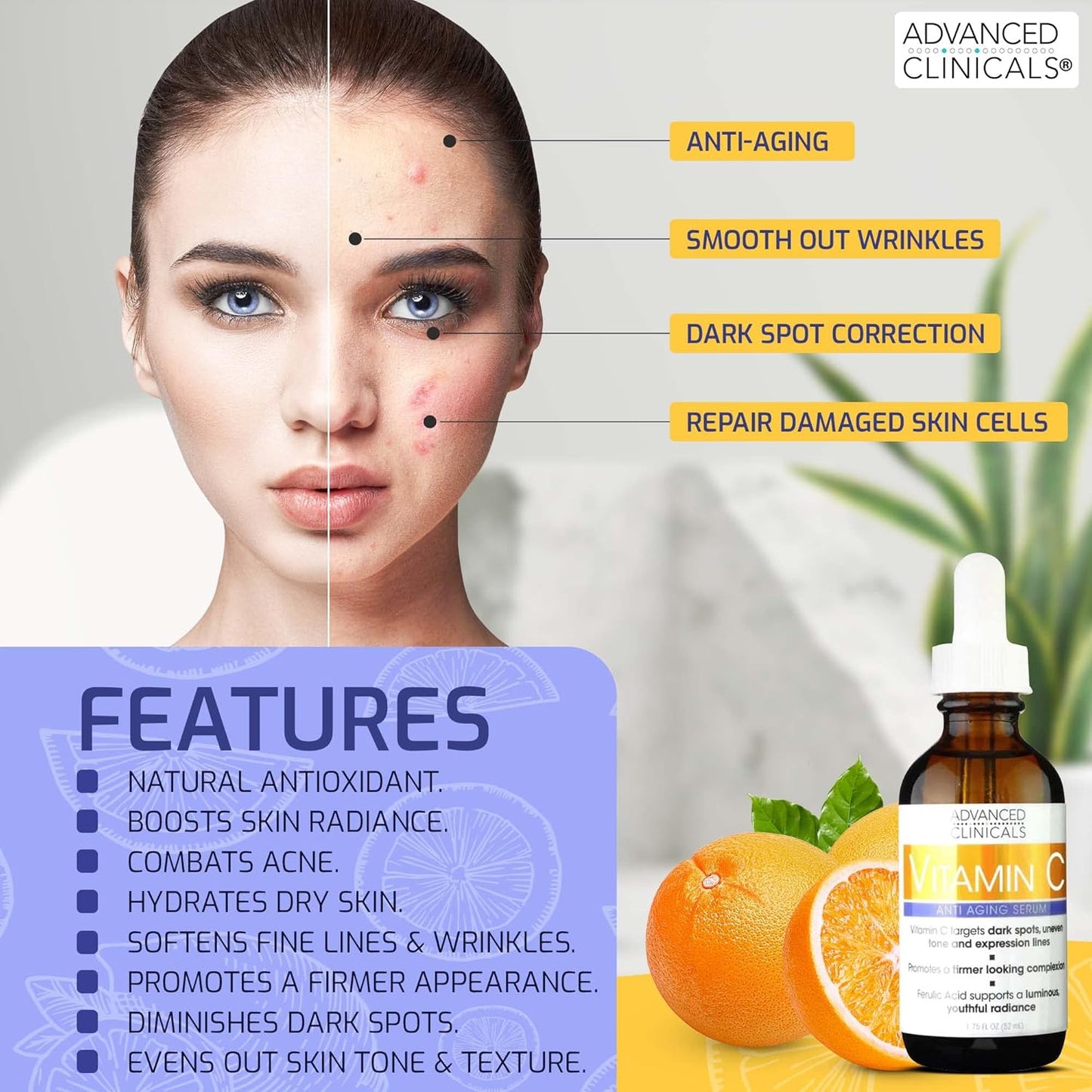 Advanced Clinicals Retinol Serum For Face + Hyaluronic Acid Serum + Vitamin C Serum Skincare Set | Face Serum For Women | Anti Aging Serums For Brightening, Firming, & Hydrating | 1.75 Fl Oz, 3pc Set